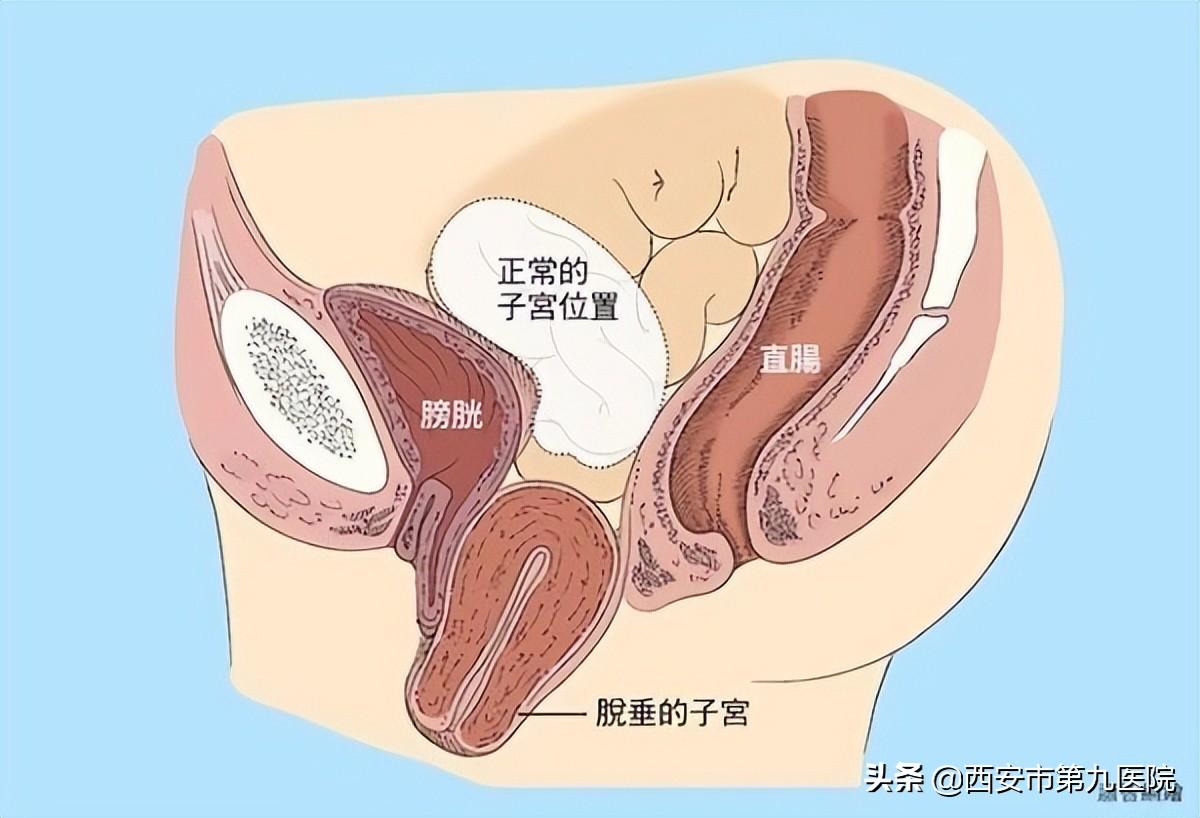 睪丸下垂松弛的原因及治療方法，睪丸下垂松弛的原因與治療方法解析