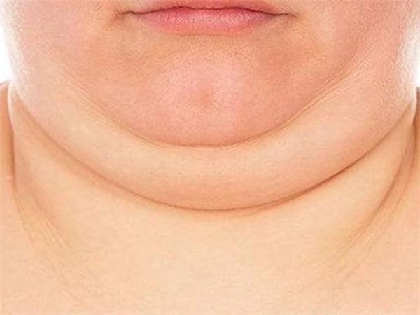 如何有效去除雙下巴贅肉——實用指南，實用指南，如何有效去除雙下巴贅肉