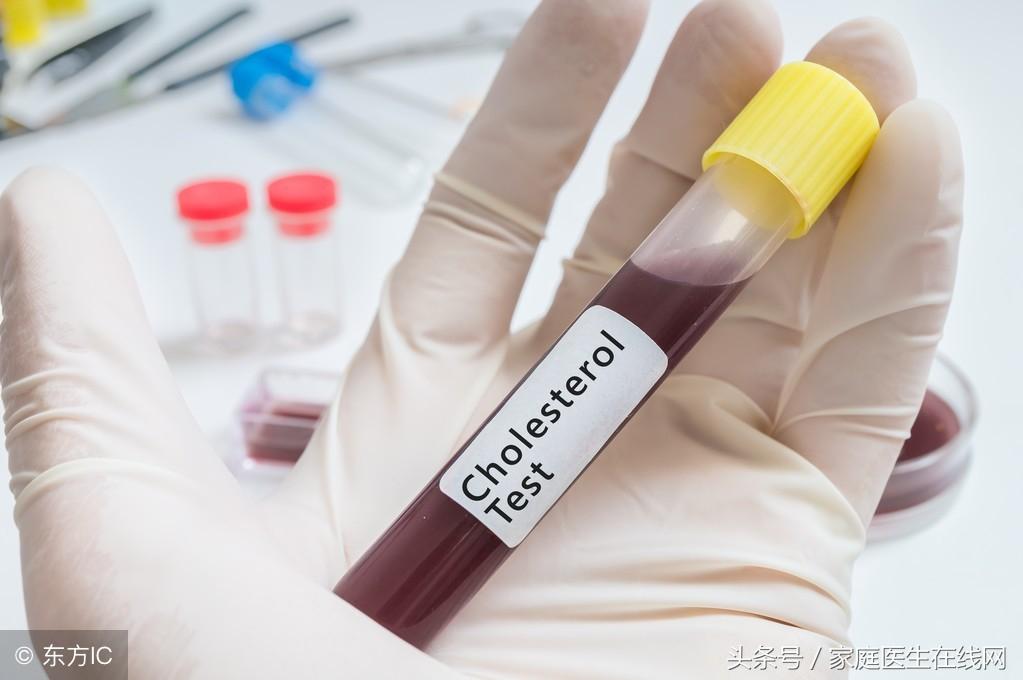 糖尿病的成因，深度解析其背后的原因，深度解析糖尿病成因，揭示背后原因真相