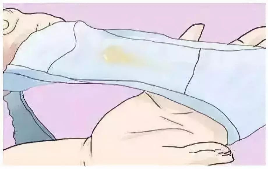 了解女性健康，白帶是什么樣子的圖片詳解，女性健康知識普及，白帶形態(tài)詳解及圖片介紹